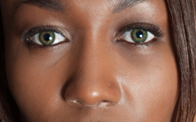 CONTACTOLOGIE ET ADAPTATION LENTILLES